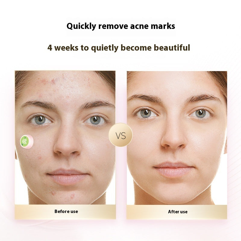 Electronic Red Blue Light Acne Removing Beauty And Skin Rejuvenation